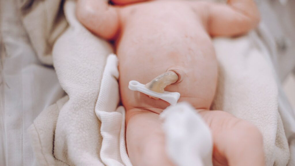 benefits of delayed cord clamping